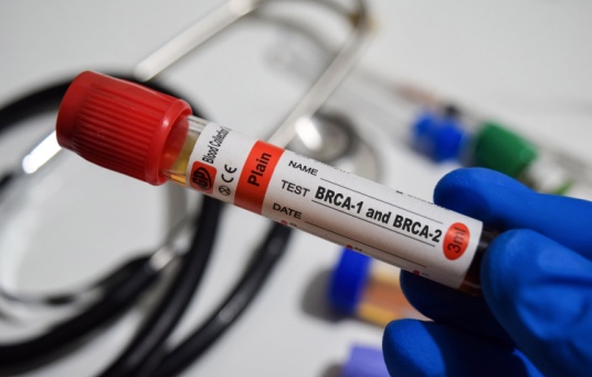 ניהול הטיפול הרפואי בנשאיות BRCA בעידן בדיקות הסקר: פיתוח מדיניות לאומית אחידה למעקב והפחתת סיכון